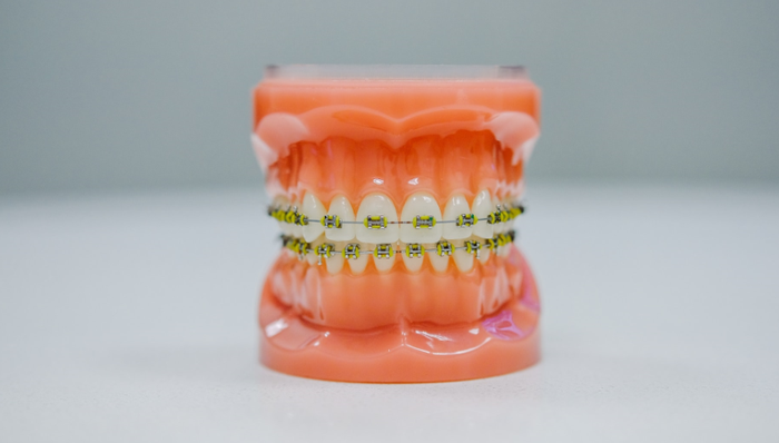 时代天使,口腔正畸,估值