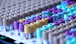 Biotech成長是一場修行，能承受贊美與質(zhì)疑才可能贏