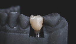 種植牙集采背后，行業(yè)破局需向上游挺進(jìn)