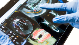 “牙科茅”终于要翻身了吗？