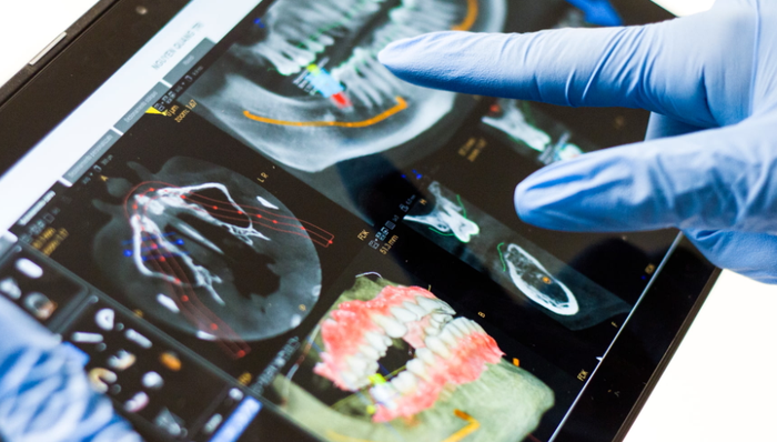 通策医疗,股价,种植牙