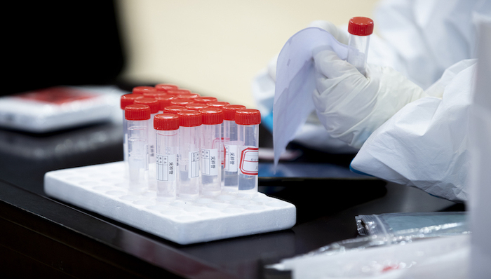 IPO,医药,新冠肺炎,核酸检测