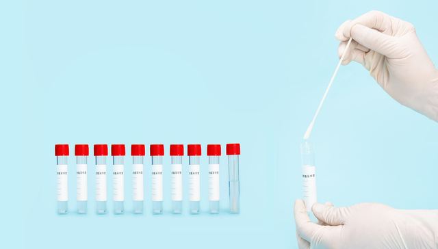 瑞博奥IPO：核酸检测撑起业绩半壁江山，但“后遗症”也不少