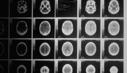 肿瘤NGS行业的命运，短期由谁决定？