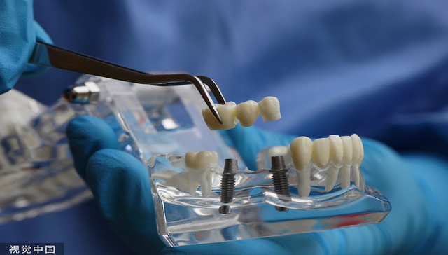 国家医保局：种植牙不入医保报销，但会研究服务费用政策