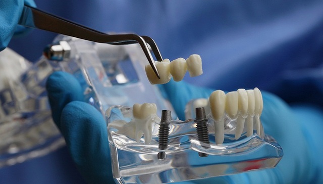 “牙茅”通策医疗今年前三季度业绩下滑，公司称集采后种植牙放量可期