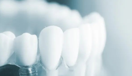 从种植牙到正畸：万元集采打7折，国产耗材机会来了？