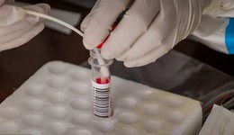 貴陽等多地核酸檢測開始收費(fèi)，重點人群等仍是免費(fèi)