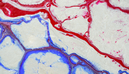 13.5亿美元，默沙东大手笔布局下一代潜在免疫靶点