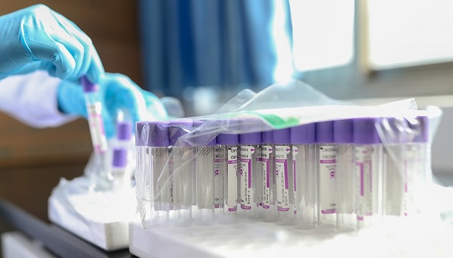 体外诊断行业最大规模集采即将启动