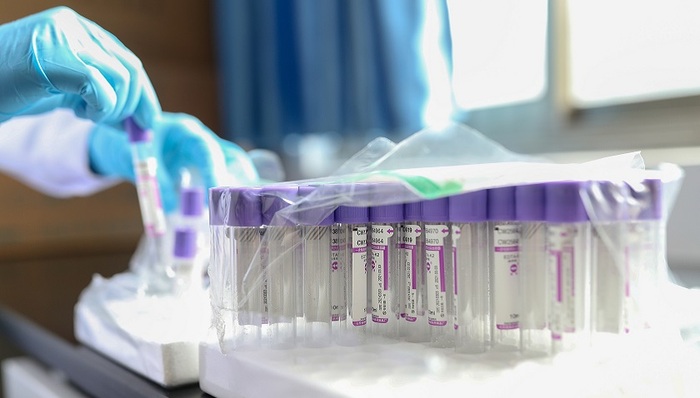 体外诊断行业最大规模集采即将启动