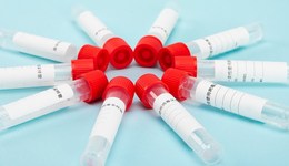 山東醫(yī)療機(jī)構(gòu)不再查驗(yàn)核酸結(jié)果，多地放寬就醫(yī)核酸限制