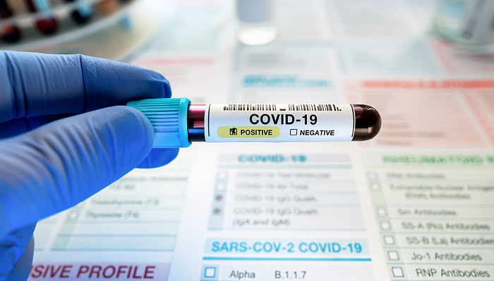 北京普惠健康保增加2万元新冠责任，还有哪些保险产品为疫情“中招”保驾护航？