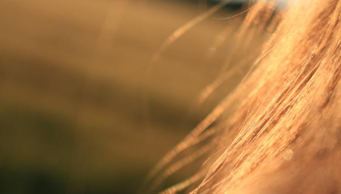 科笛集团,脱发经济,植发,