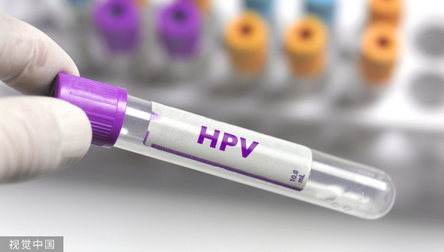 北交所最大IPO缩水，康乐卫士超30亿募资变3亿