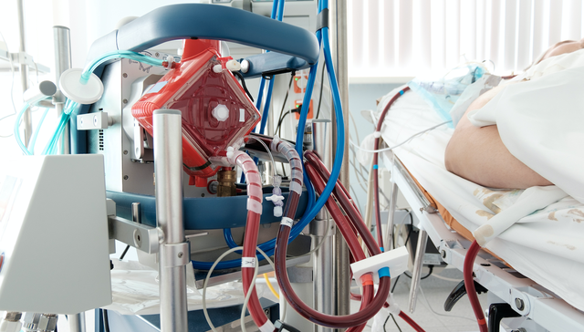 ECMO,汉诺医疗