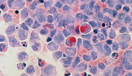 国内肿瘤NGS企业大出海，寻找技术和商业的跨越