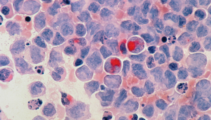 海外市场,癌症早筛,商业化,