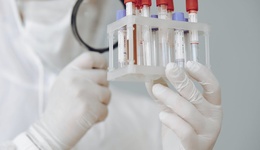 一代代药王陨落，但EGFR靶点的黄金时代刚开始