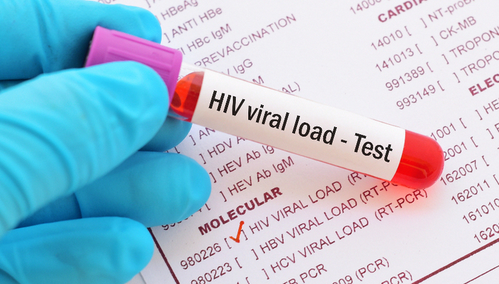 全球第三例艾滋病“治愈”案例，但其疗法还不能大规模应用