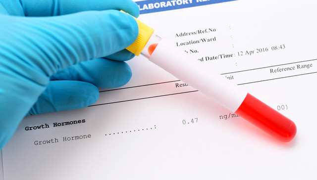 财说｜从低谷中反弹？安科生物年报透露这些信息