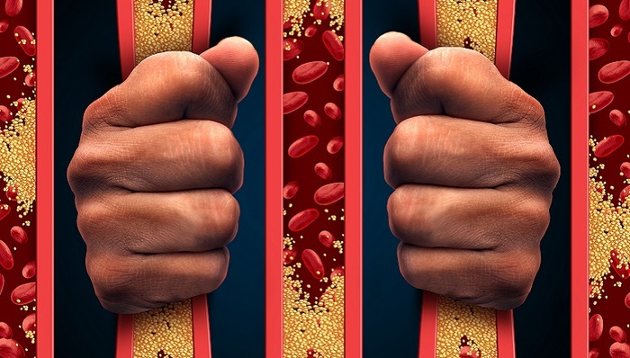 君实生物对诺华明星药发起专利无效请求，新一代降脂药专利战又起