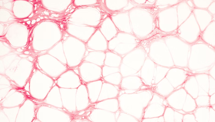 心血管医疗,商业化,波士顿科学,收购,