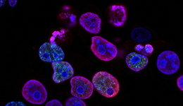 黑色素瘤，为什么是肿瘤治疗“产业革命”风向标？