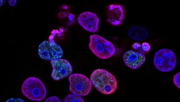 黑色素瘤,临床医疗,