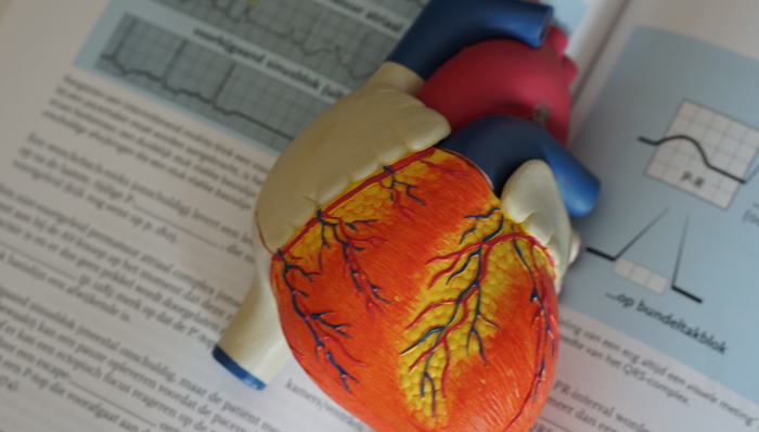 人工心脏,收购,产品研发,