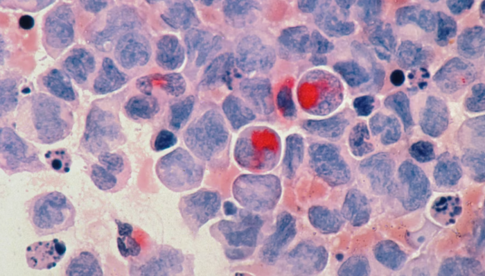 燃石医学,亏损,癌症早筛,