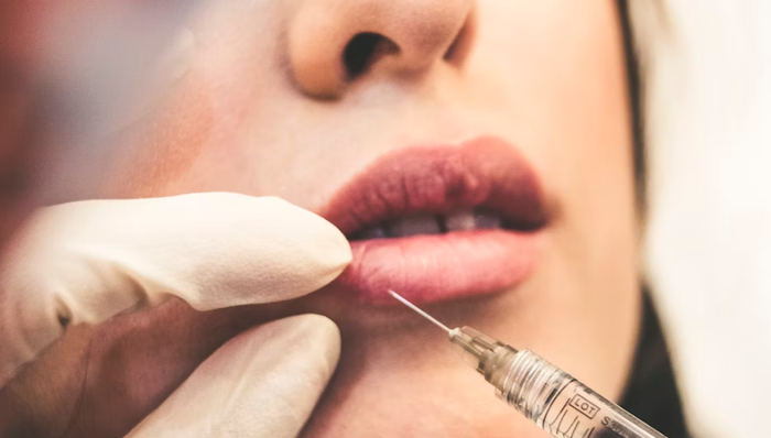 融资,市场竞争,医美,监管,