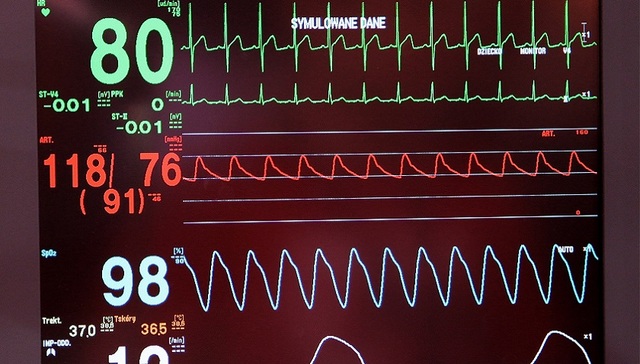全球最小的人工心脏获批上市