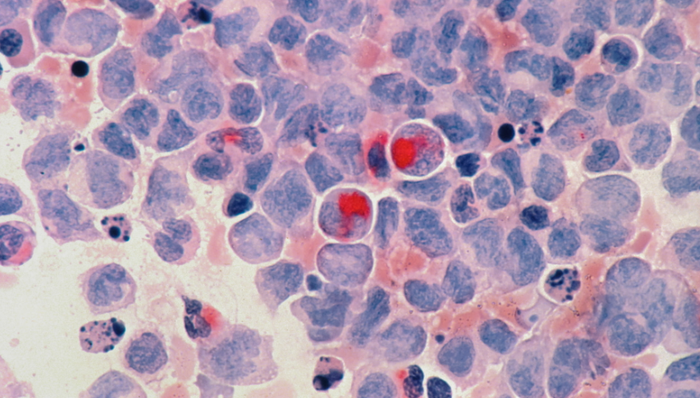 商业化,微创治疗,