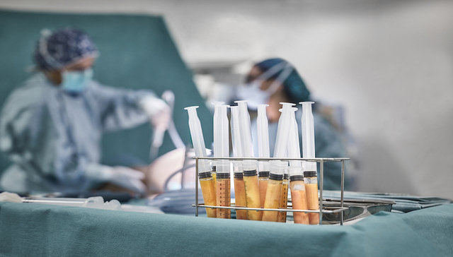 加科思核心产品遭艾伯维退回，创新药出海再受挫