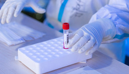 “三陽”來了？新冠檢測板塊異動，易瑞生物20CM漲停，多家檢測公司回應：業(yè)務影響有限