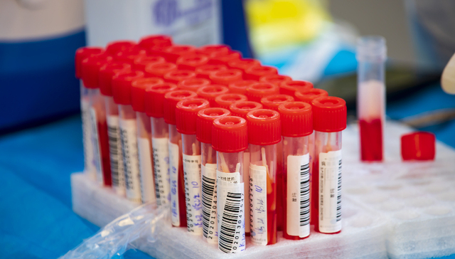 抗疫明星股之江生物上半年业绩大跌超九成，存货占比也远超同行