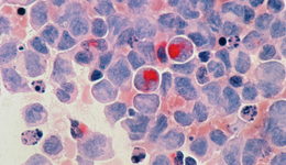 明星公司CEO為員工找出路，細(xì)胞療法的分化時刻