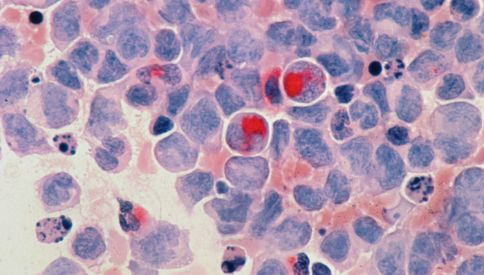 细胞疗法,商业化,