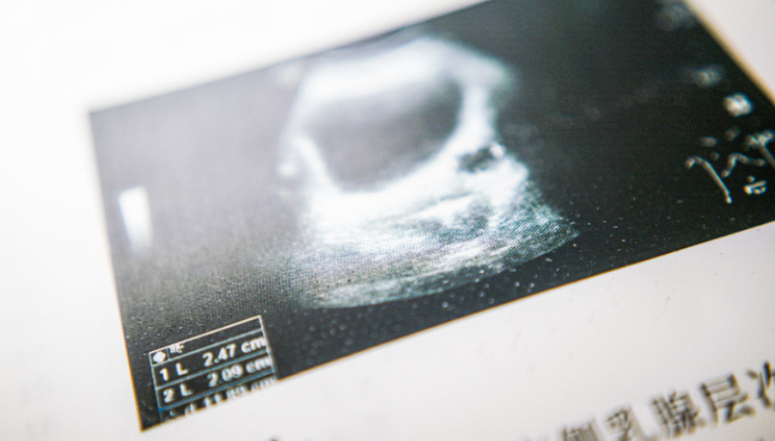 医疗影像,融资,VC,行业观察,