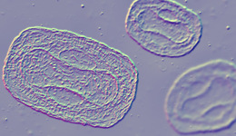 本土猴痘病例3個(gè)月破千，1名非性接觸密接者感染