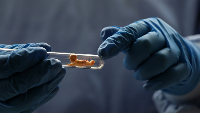 头部民营辅助生殖医院爱维艾夫拟港股IPO：试管婴儿支出平均接近6万，行业天花板受观念限制