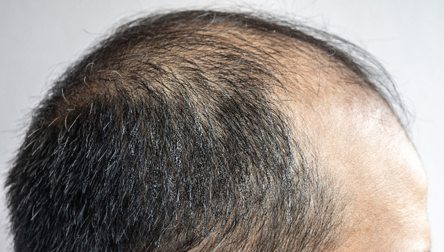 虚假宣传！任泽平宣称能生发防脱的洗护产品被处罚