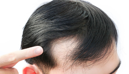 雍禾醫(yī)療跌成了“禿頭”