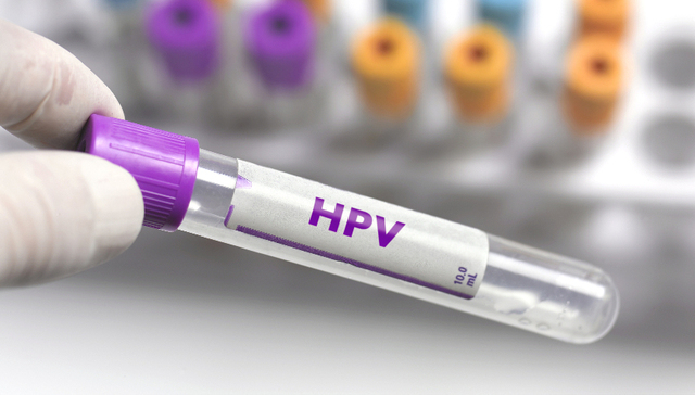 九价HPV疫苗去年供应量翻倍，但这些认知误区依然存在