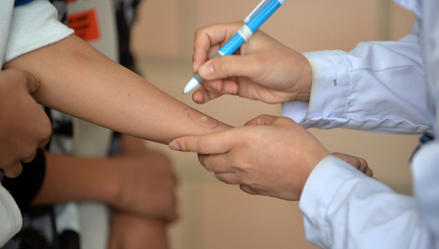 张文宏称终止结核病依然非常艰难，中国方案能否扭转困境？|世界防治结核病日