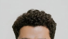 兩年虧6億，雍禾植發(fā)頭也“禿”