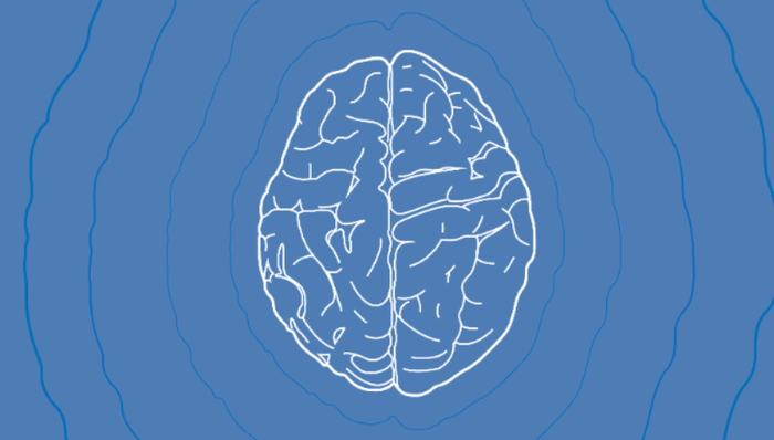 医学研究,阿尔茨海默症,医药,