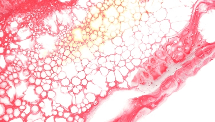 商业化,医疗器械,创新,