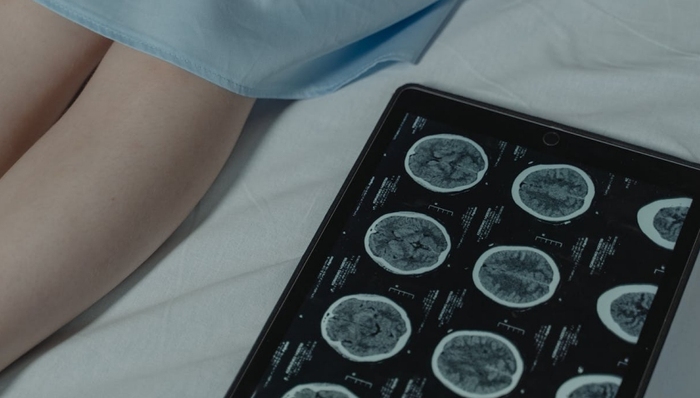 强生,罗氏制药,血液瘤,癌症,